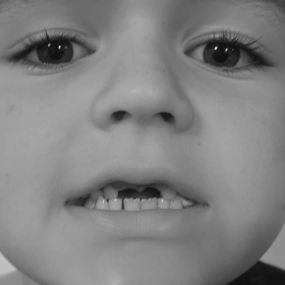 Boy missing front teeth